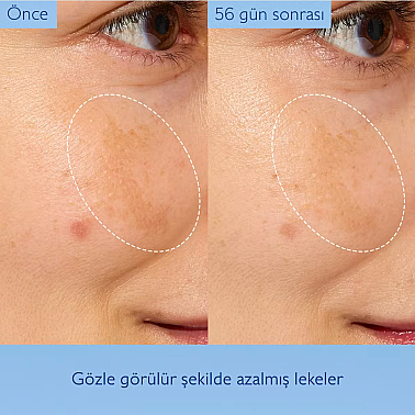 Caudalie Vinoperfect Leke Karşıtı ve Işıltı Verici Glikolik Esans 100 ml - 4